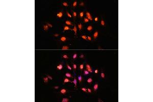 Immunofluorescence analysis of U-2 OS cells using PHLPP1 Polyclonal Antibody (ABIN6128434, ABIN6145573, ABIN6145574 and ABIN6225035) at dilution of 1:100 (40x lens).