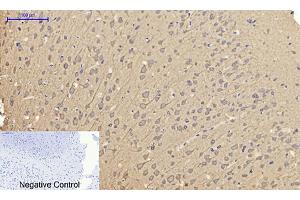 Immunohistochemical analysis of paraffin-embedded rat brain tissue. (Caveolin-1 Antikörper  (AA 100-180))