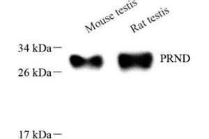 Western blot analysis of DPL (ABIN7075176),at dilution of 1: 1000 (PRND Antikörper)