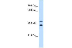 WB Suggested Anti-GDE1 Antibody Titration:  0. (GDE1 Antikörper  (N-Term))