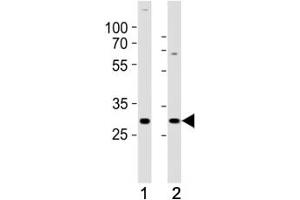 Western blot analysis of lysate from (1) SH-SY5Y and (2) MCF-7 cell line using HES1 antibody at 1:1000. (HES1 Antikörper  (C-Term))