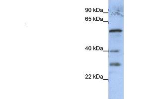 WB Suggested Anti-GADL1  Antibody Titration: 0. (GADL1 Antikörper  (Middle Region))