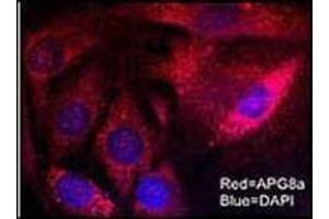 Immunofluorescent staining of Mouse brain cells using LC3 (MAP1LC3A Antikörper  (N-Term))