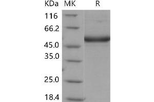 Western Blotting (WB) image for CD302 (CD302) protein (Fc Tag) (ABIN7320182) (DCL1 Protein (Fc Tag))