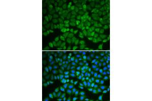 Immunofluorescence analysis of A549 cell using GSS antibody. (Glutathione Synthetase Antikörper)
