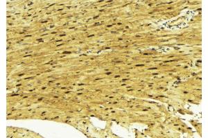 ABIN6269312 at 1/100 staining Mouse muscle tissue by IHC-P. (MEF2A Antikörper  (Internal Region))