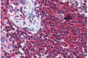 Human Spleen: Formalin-Fixed, Paraffin-Embedded (FFPE) (STIP1 Antikörper  (AA 445-544))