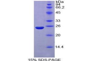 SDS-PAGE analysis of Mouse Nucleoporin 160 kDa Protein. (NUP160 Protein)