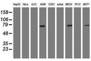 Image no. 2 for anti-Receptor (TNFRSF)-Interacting serine-threonine Kinase 1 (RIPK1) (AA 133-422) antibody (ABIN1490913) (RIPK1 Antikörper  (AA 133-422))