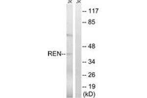 Western blot analysis of extracts from Jurkat cells, using REN Antibody. (Renin Antikörper  (AA 207-256))