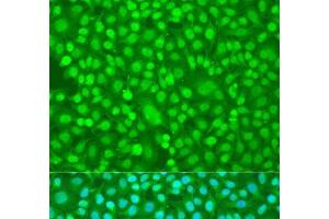 Immunofluorescence analysis of U2OS cells using PER1 Polyclonal Antibody at dilution of 1:100. (PER1 Antikörper)