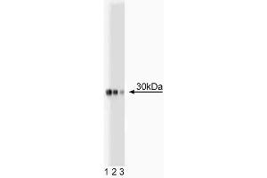 Western blot analysis of Acrp30 on plasma lysate. (ADIPOQ Antikörper  (AA 1-247))