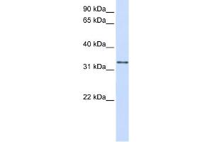 WB Suggested Anti-GPSN2 Antibody Titration:  0. (TECR Antikörper  (C-Term))