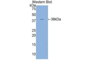 Western blot analysis of the recombinant protein. (Cardiac Troponin T2 Antikörper  (AA 1-295))
