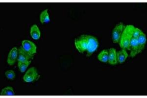 Immunofluorescent analysis of MCF-7 cells using ABIN7162466 at dilution of 1:100 and Alexa Fluor 488-congugated AffiniPure Goat Anti-Rabbit IgG(H+L) (PDRG1 Antikörper  (AA 1-133))