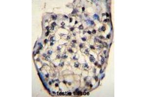 Immunohistochemistry (IHC) image for anti-Outer Dense Fiber of Sperm Tails 3 (ODF3) antibody (ABIN2996385) (ODF3 Antikörper)