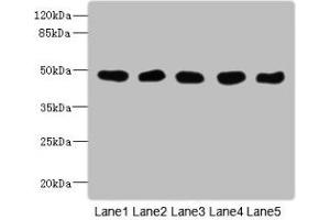 Western Blot All lanes: GCDH antibody at 8 μg/mL Lane 1: Mouse kidney tissue Lane 2: Mouse liver tissue Lane 3: Hela whole cell lysate Lane 4: MCF-7 whole cell lysate Lane 5: LO2 whole cell lysate Secondary Goat polyclonal to rabbit IgG at 1/10000 dilution Predicted band size: 49, 48 kDa Observed band size: 49 kDa (GCDH Antikörper  (AA 45-300))