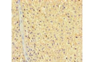Immunohistochemistry of paraffin-embedded human adrenal gland tissue using ABIN7176291 at dilution of 1:100 (Zinc Finger Protein 44 Antikörper  (AA 1-300))