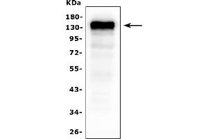 Western blot analysis of CD22 using anti ZO-1 antibody (ABIN7602740).
