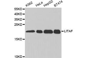 Western blot analysis of extracts of various cell lines, using LITAF antibody (ABIN5973182) at 1/1000 dilution. (LITAF Antikörper)