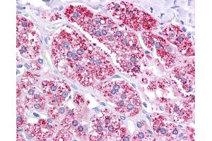 Immunohistochemistry (IHC) image for anti-ATP-Binding Cassette, Sub-Family B (MDR/TAP), Member 1 (ABCB1) (Middle Region) antibody (ABIN2773986)