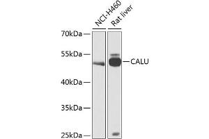 Western blot analysis of extracts of various cell lines, using CALU antibody (ABIN6129532, ABIN6137877, ABIN6137879 and ABIN6216027) at 1:1000 dilution. (CALU Antikörper  (AA 20-315))