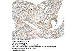 Rabbit Anti-CKMT2 Antibody  Paraffin Embedded Tissue: Human Muscle Cellular Data: Skeletal muscle cells Antibody Concentration: 4. (CKMT2 Antikörper  (N-Term))