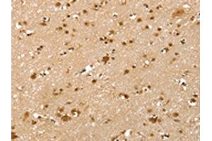 The image on the left is immunohistochemistry of paraffin-embedded Human brain tissue using ABIN7192547(SLTM Antibody) at dilution 1/40, on the right is treated with synthetic peptide. (SLTM Antikörper)