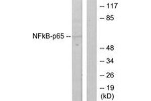 Western blot analysis of extracts from HeLa cells, using NF-kappaB p65 (Ab-536) Antibody. (NF-kB p65 Antikörper  (AA 502-551))