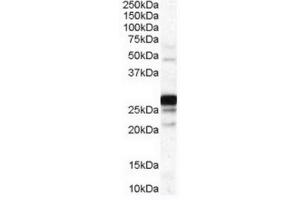 Image no. 1 for anti-Catechol-O-Methyltransferase (COMT) (Internal Region) antibody (ABIN374718) (COMT Antikörper  (Internal Region))