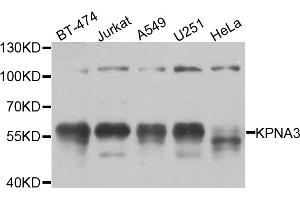 Western blot analysis of extracts of various cell lines, using KPNA3 antibody (ABIN5974559) at 1/1000 dilution. (KPNA3 Antikörper)