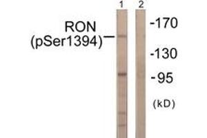 Western blot analysis of extracts from HeLa cells treated with TNF-a 20ng/ml 2', using CD136/RON (Phospho-Ser1394) Antibody. (MST1R Antikörper  (pSer1394))