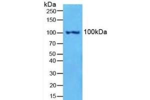 Detection of NFkB2 in Mouse Spleen Tissue using Polyclonal Antibody to Nuclear Factor Kappa B2 (NFkB2) (Nuclear Factor kappa B2 (AA 38-343) Antikörper)
