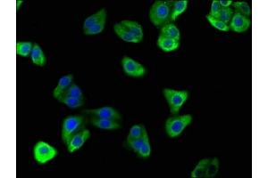 Immunofluorescence staining of HepG2 cells with ABIN7175242 at 1:166, counter-stained with DAPI. (ATP6VD2 (AA 50-295) Antikörper)