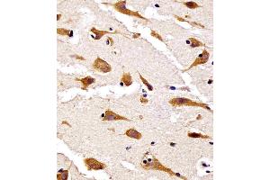 (ABIN6242448 and ABIN6578653) staining RPS27 in human brain tissue sections by Immunohistochemistry (IHC-P - paraformaldehyde-fixed, paraffin-embedded sections). (RPS27 Antikörper  (AA 5-37))
