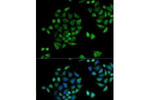 Immunofluorescence analysis of U2OS cells using CYP2C9 Polyclonal Antibody (CYP2C9 Antikörper)