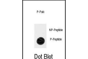 Dot blot analysis of anti-Phospho-ACK1-p Antibody (ABIN389970 and ABIN2839765) on nitrocellulose membrane. (TNK2 Antikörper  (pTyr518))