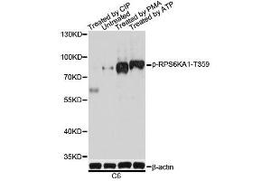 Western blot analysis of extracts of C6 cells, using Phospho-RPS6KA1-T359 antibody. (RPS6KA1 Antikörper  (pSer363))