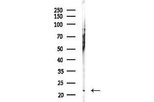 anti-SAR1 Homolog A (SAR1A) (Internal Region) antibody