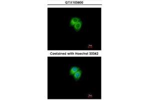 ICC/IF Image Immunofluorescence analysis of methanol-fixed Hep G2, using Adenylate kinase 7, antibody at 1:500 dilution. (Adenylate Kinase 7 Antikörper)