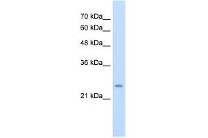 WB Suggested Anti-CHIC1 Antibody Titration:  5. (CHIC1 Antikörper  (N-Term))