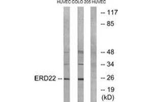 Western blot analysis of extracts from HuvEc/COLO cells, using ERD22 Antibody. (KDELR2 Antikörper  (AA 81-130))