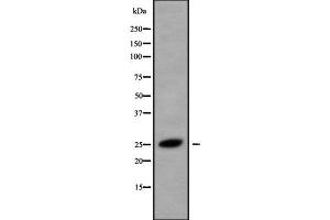 Western blot analysis of CMTM5 using HeLa whole cell lysates (CMTM5 Antikörper  (Internal Region))
