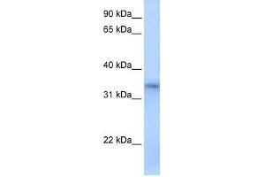 FHL5 antibody used at 0.