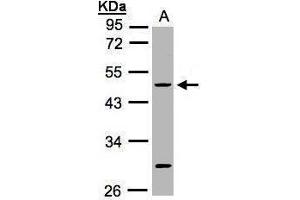 WB Image Sample(30 ug whole cell lysate) A:HeLa S3, 10% SDS PAGE antibody diluted at 1:1000 (KRT20 Antikörper  (C-Term))