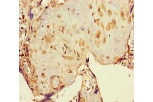 Immunohistochemistry of paraffin-embedded human placenta tissue using ABIN7162411 at dilution of 1:100 (NR1H3 Antikörper  (AA 1-402))