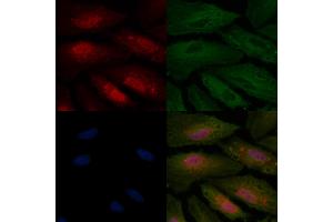 ABIN6256975 and ABIN6275033 staining  cells by IF/ICC. (C1QBP Antikörper  (Internal Region))