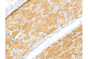 Phospho-PYGL (Ser15) Antibody at 1/100 staining Rat ovarian tissue by IHC-P. (PYGL Antikörper  (pSer15))