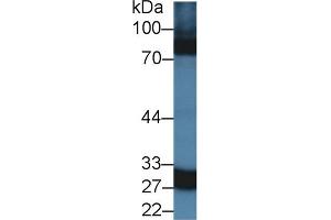 Western Blot; Sample: Rat Spleen lysate; Primary Ab: 1. (CA5A Antikörper  (AA 12-219))
