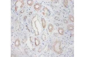 Immunohistochemistry of paraffin-embedded human kidney tissue using ABIN7176559 at dilution of 1:100 (ZFP91 Antikörper  (AA 1-208))
